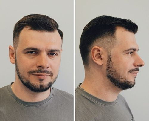 blekna haircut for men with receding hairline