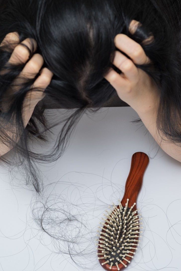 kvinna hair loss problem