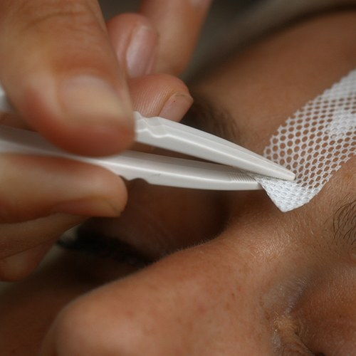 3d printed facial patches