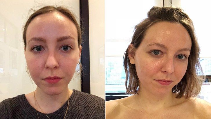 Locka editor Sarah Kinonen before and after Joanna Vargas facial photos