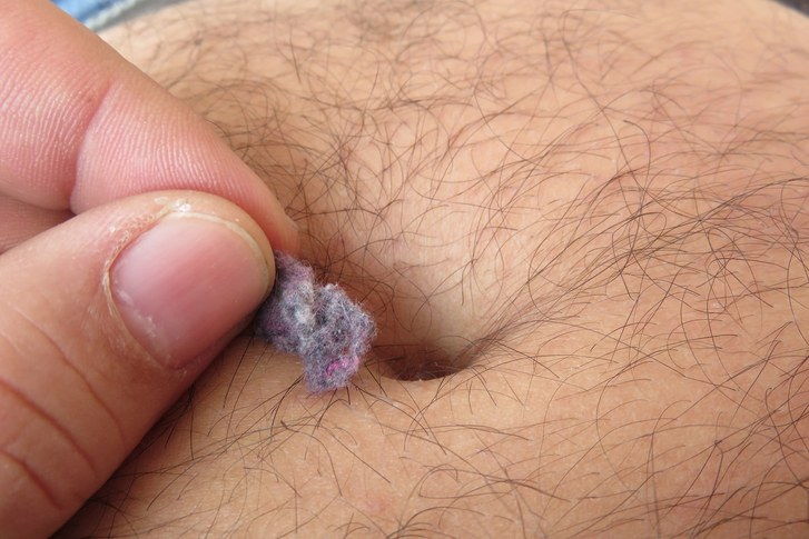 Man picking belly button lint out of belly button